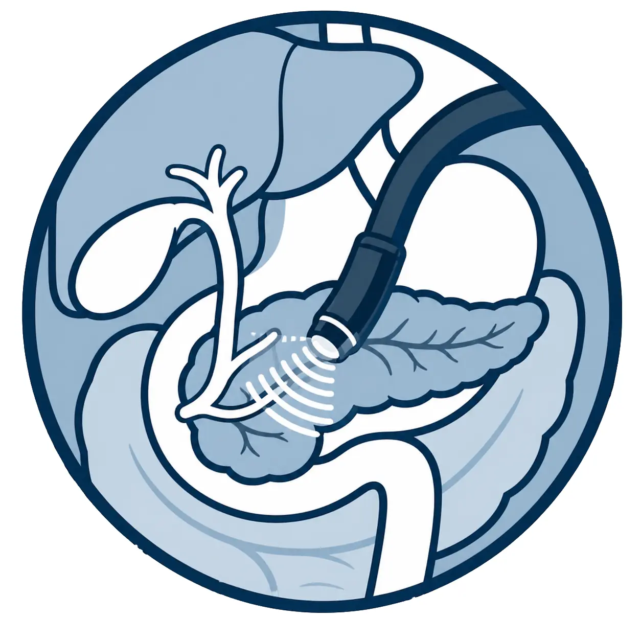 Endosonographie (Diagnostik von Gallenwegen und Bauchspeicheldr&uuml;se)