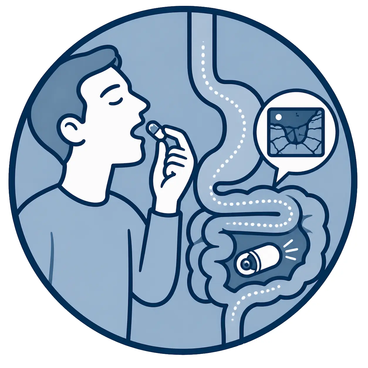 Kapselendoskopie (D&uuml;nndarmdiagnostik)